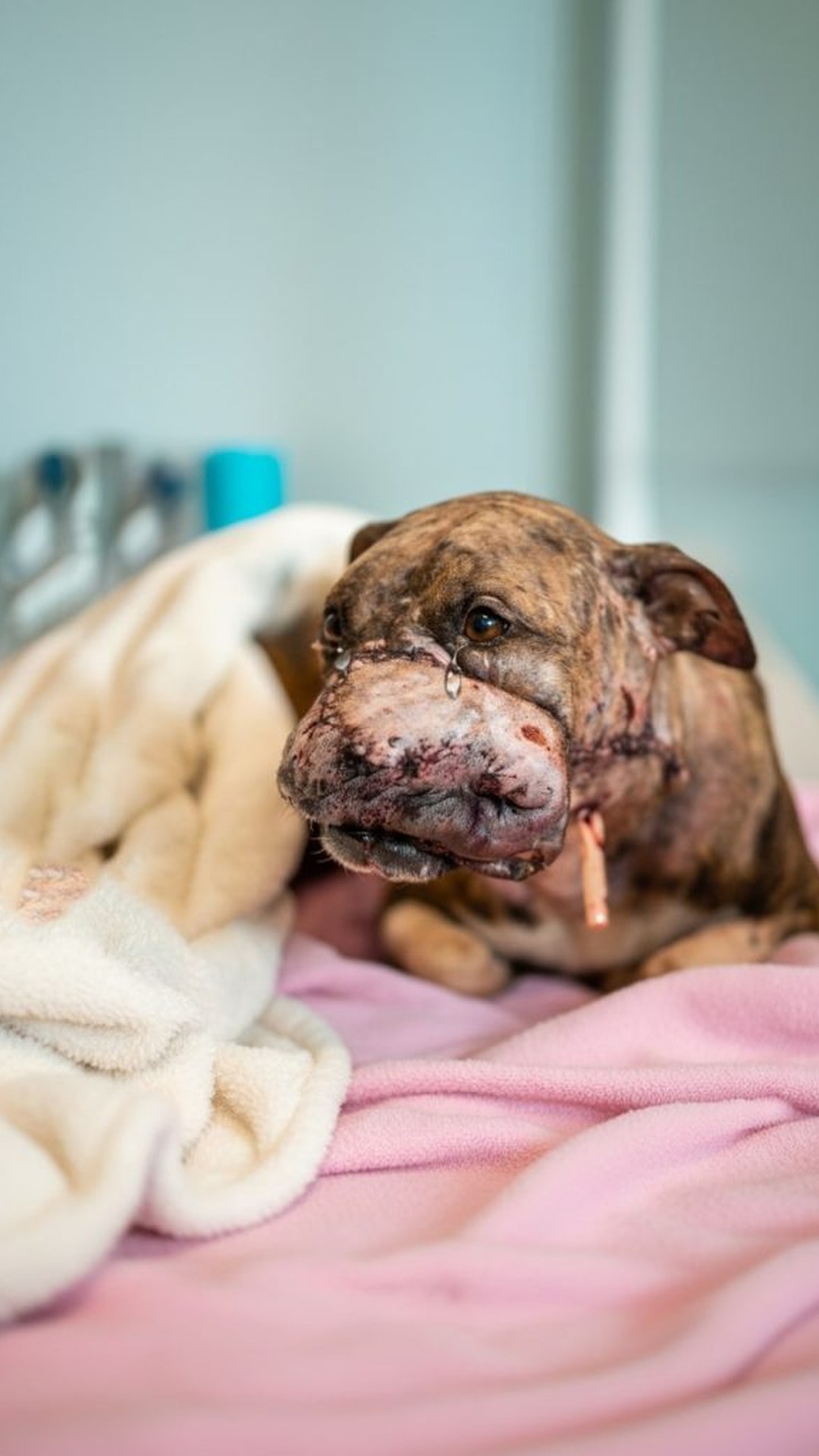 Amber’s Remarkable Recovery and Her First Taste of Ice Cream