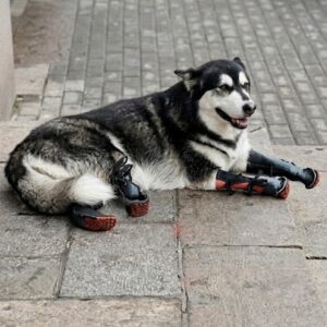 Da Hei Takes His First Steps with Custom Prosthetics After Trauma