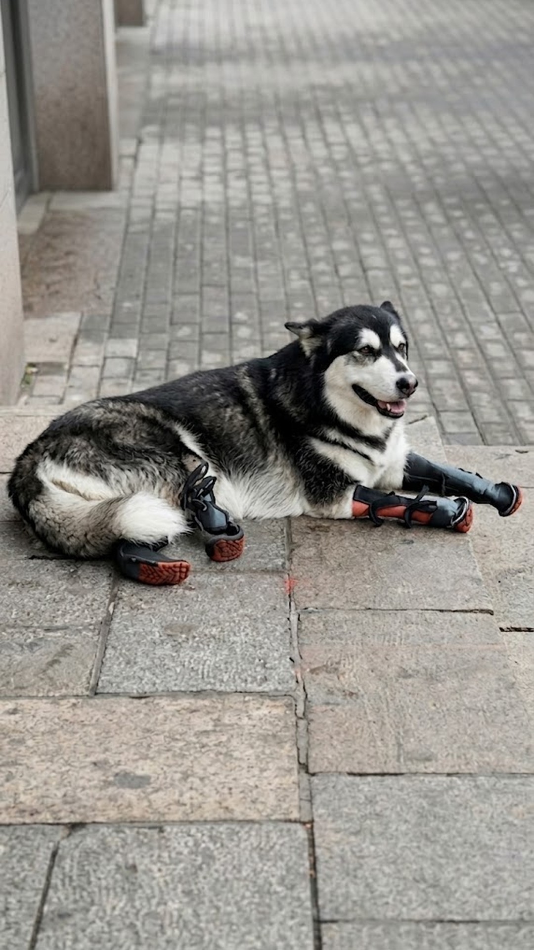 Da Hei Takes His First Steps with Custom Prosthetics After Trauma